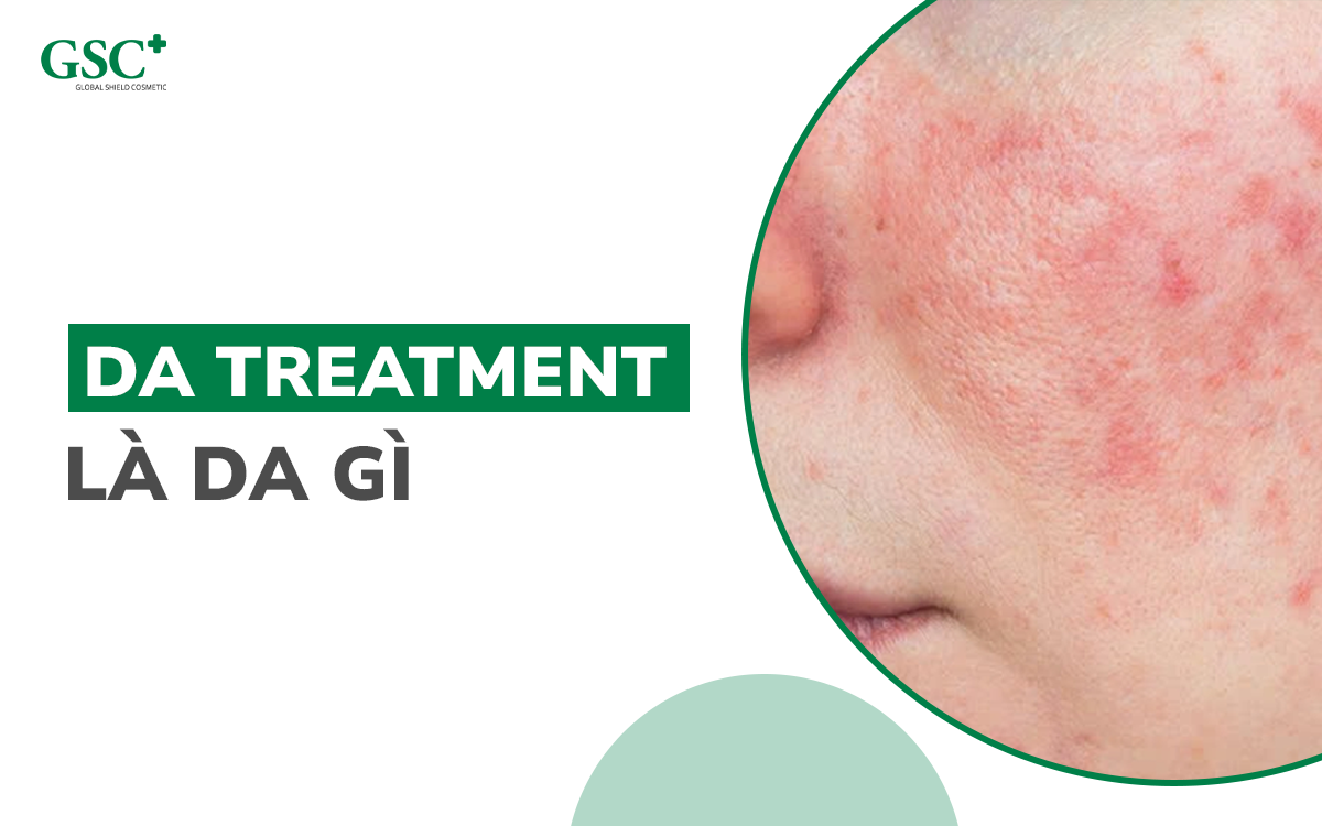 Da treatment là da gì