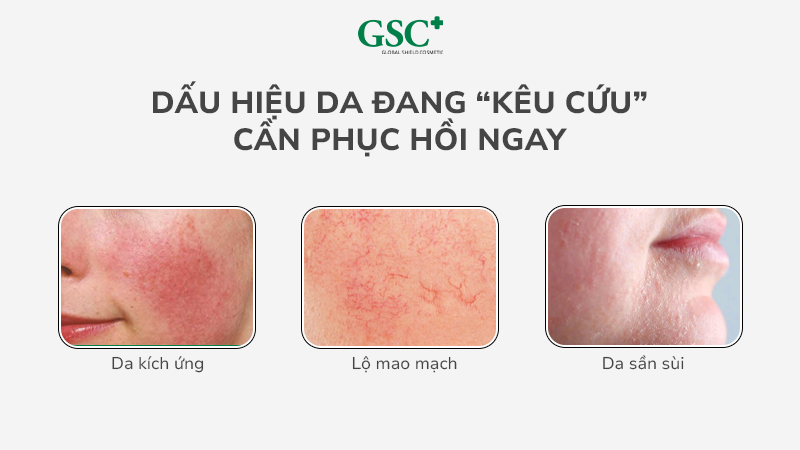 Dấu Hiệu Da Đang “Kêu Cứu” Cần Phục Hồi Ngay