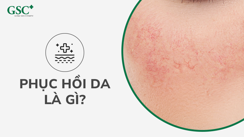 Phục hồi da là gì