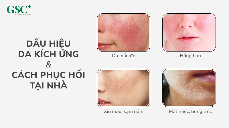 Dấu hiệu da kích ứng và cách phục hồi tại nhà