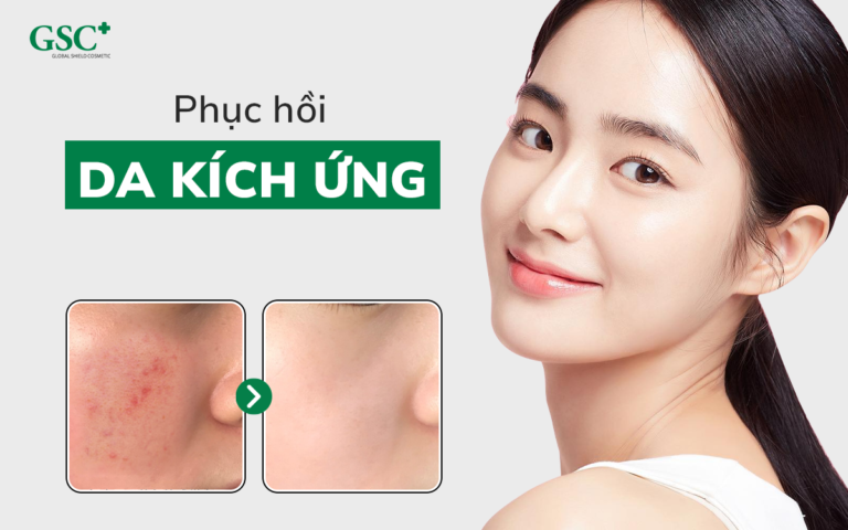 Phục hồi da kích ứng tại nhà