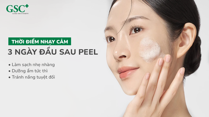 3 ngày đầu sau peel