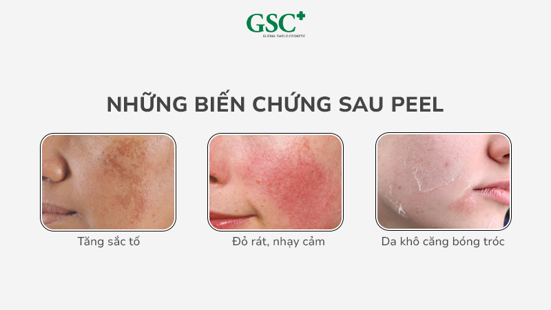 Da thường như thế nào sau peel