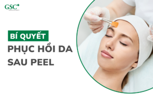 Bí quyết phục hồi da sau peel: 3 giai đoạn nhất định phải biết