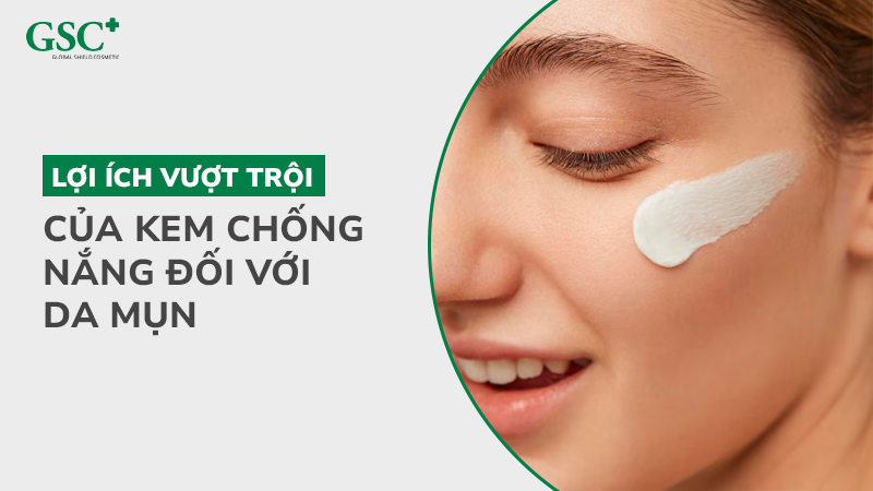 Lợi ích vượt trội của kem chống nắng