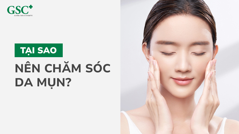 Tại sao nên chăm sóc da mụn