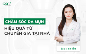 Cách chăm sóc da mụn hiệu quả từ chuyên gia tại nhà