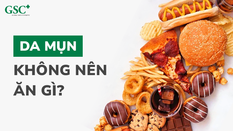 Da mụn không nên ăn gì