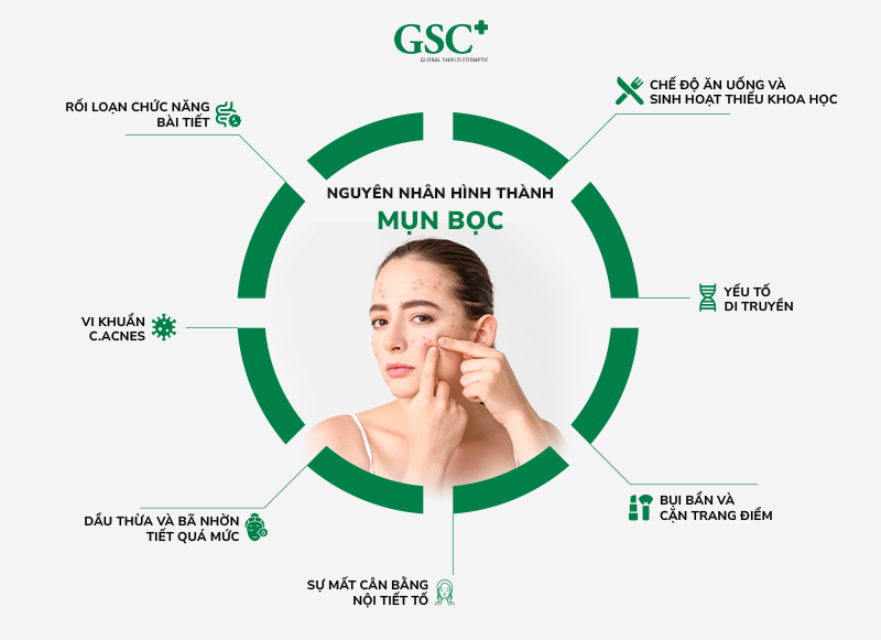 Nguyên nhân hình thành mụn bọc