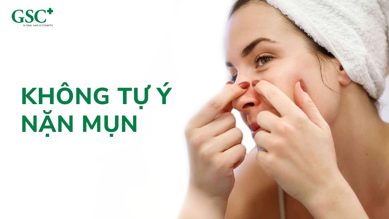 Không tự ý nặn mụn