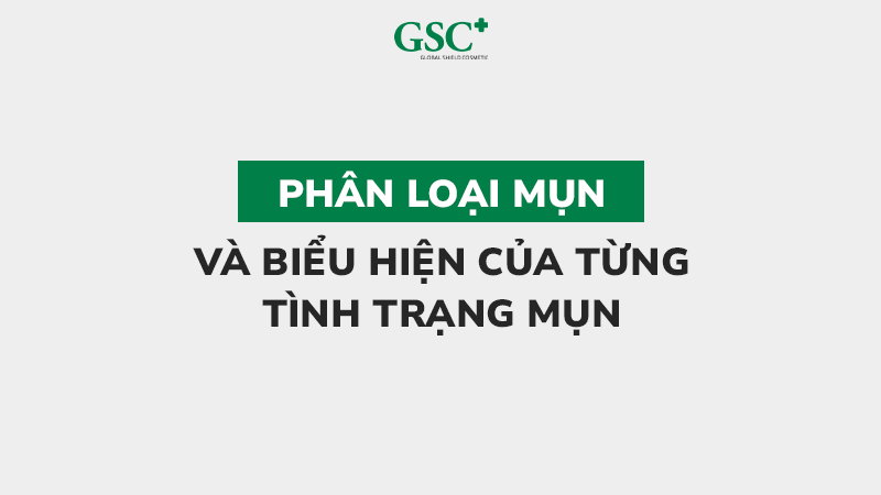 Phân loại mụn