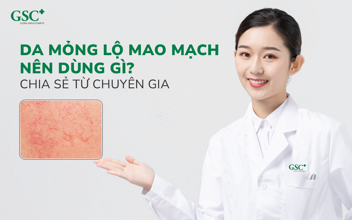 Da mỏng lộ mao mạch