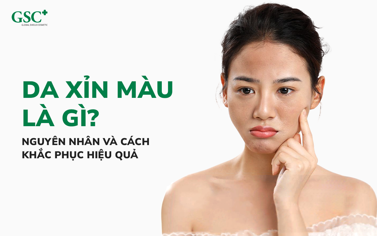 Da xỉn màu là gì