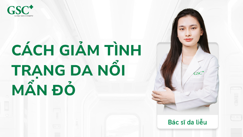 Cách giảm tình dạng da nổi mẩn đỏ