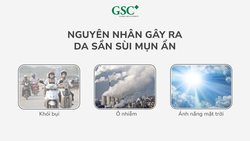 Nguyên nhân gây ra da sần sùi mụn ẩn