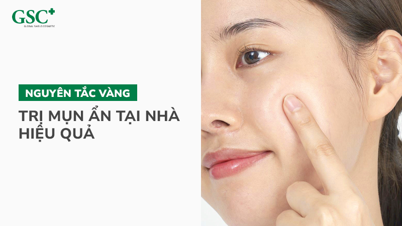 Nguyên tắc vàng để trị mụn ẩn tại nhà hiệu quả