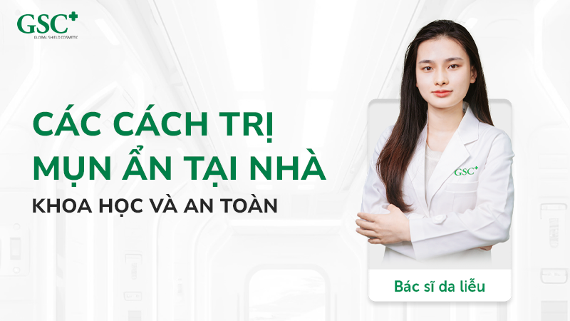 Các cách trị mụn ẩn tại nhà khoa học và an toàn