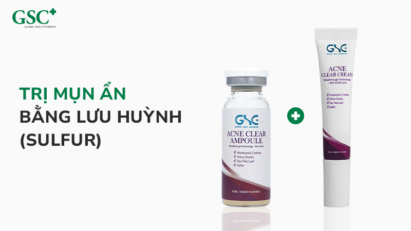 Trị mụn ẩn bằng lưu huỳnh