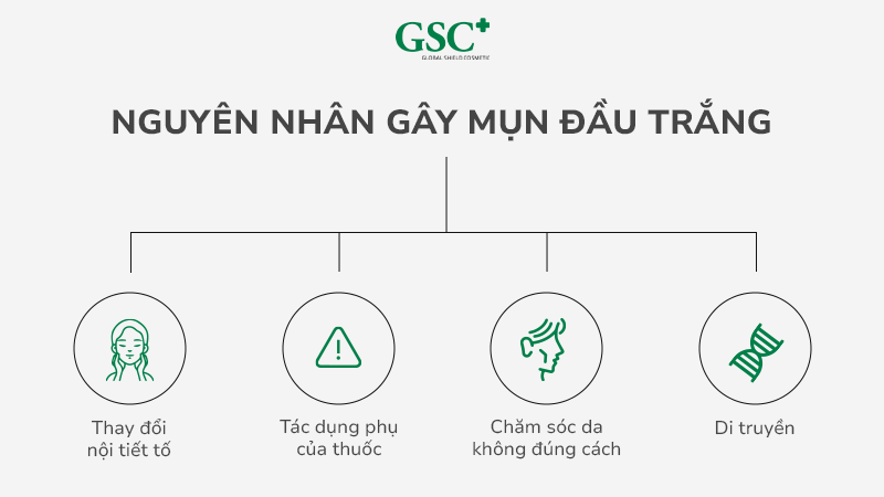 Nguyên nhân gây mụn đầu trắng