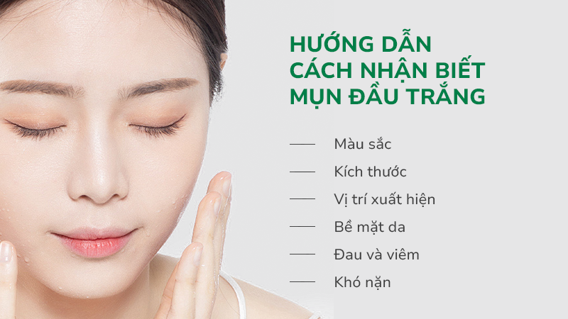 Hướng dẫn cách nhận biết mụn đầu trắng