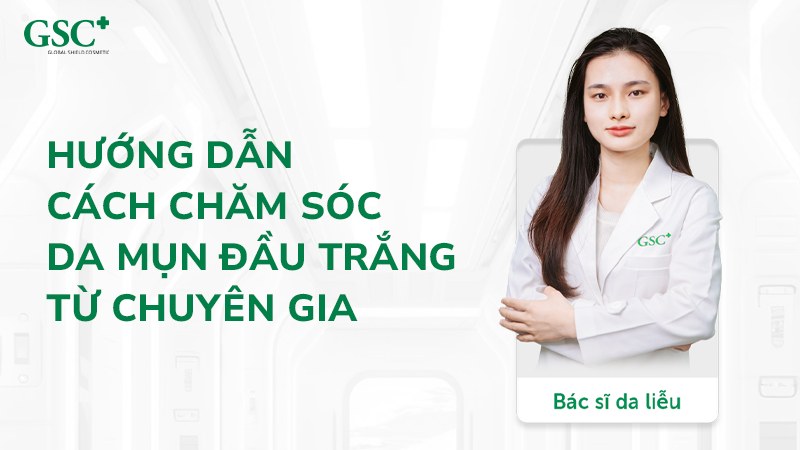 Chăm sóc mụn đầu trắng chuẩn