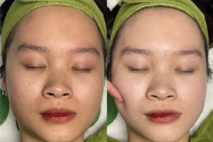 Dưỡng trắng, căng bóng