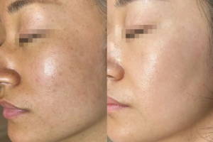 Vi kim sinh học nám