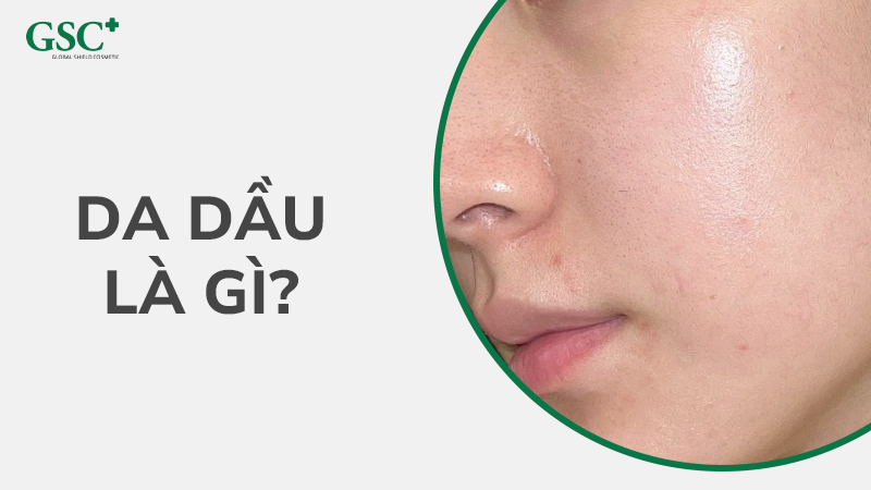 Da dầu là gì