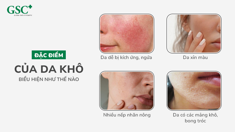 Da khô thường có đặc điểm ra sao