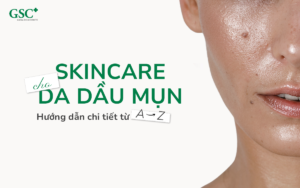 Skincare cho da dầu mụn – Hướng dẫn chi tiết từ A-Z