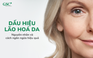 Dấu hiệu lão hoá da: Nguyên nhân và cách ngăn ngừa hiệu quả