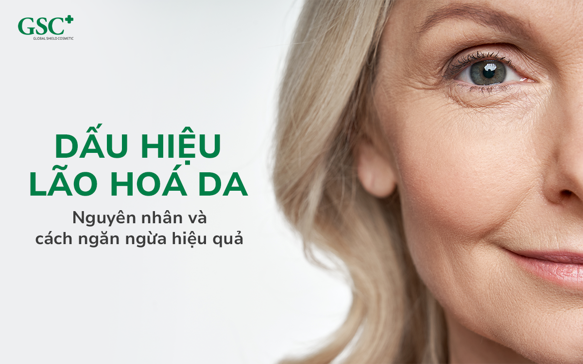 Dấu hiệu lão hoá da