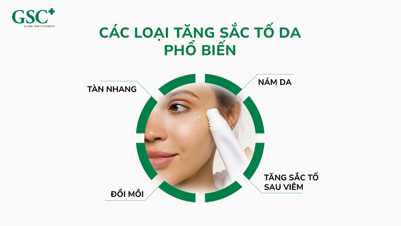 Các loại tăng sắc tố da phổ biến