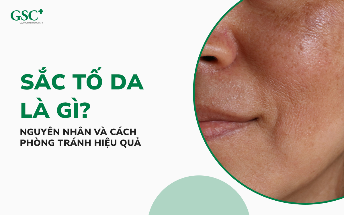 Sắc tố da là gì