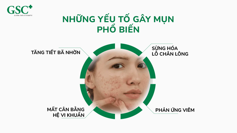 Những nguyên nhân gây mụn phổ biến
