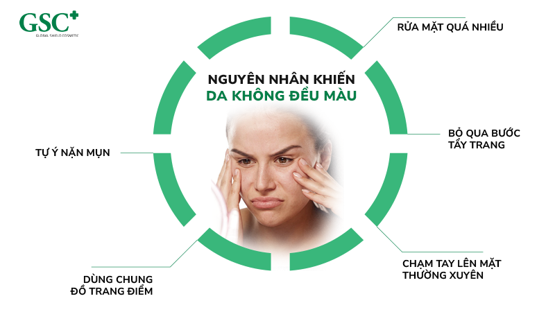 Nguyên nhân khiến da không đều màu