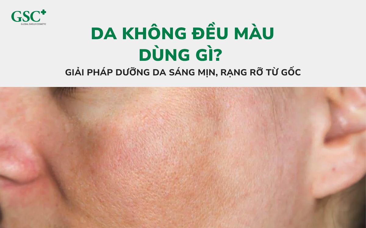 Da không đều màu dùng gì
