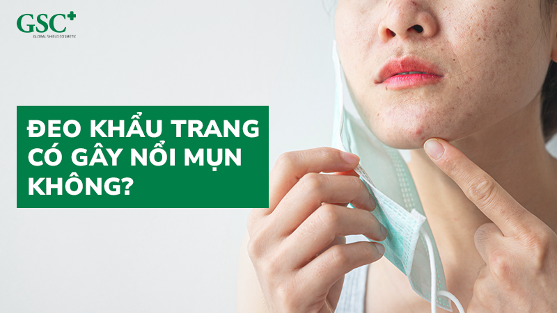 Đeo khẩu trang có gây nổi mụn không