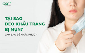#Maskne: Tại sao đeo khẩu trang bị mụn? Làm sao để khắc phục?