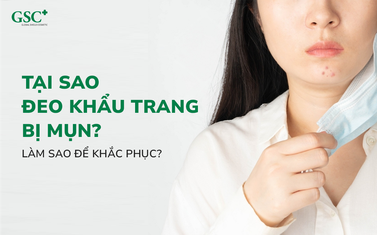 Tại sao đeo khẩu trang bị mụn