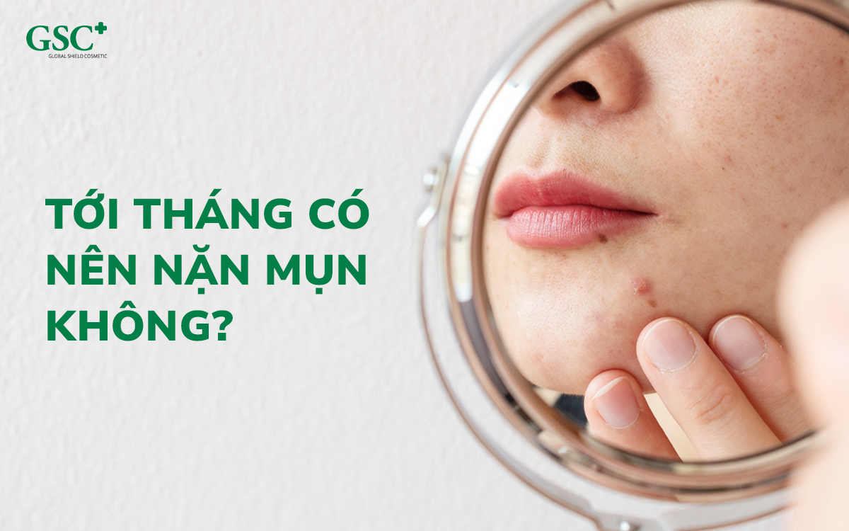 Tới tháng có nên nặn mụn không?