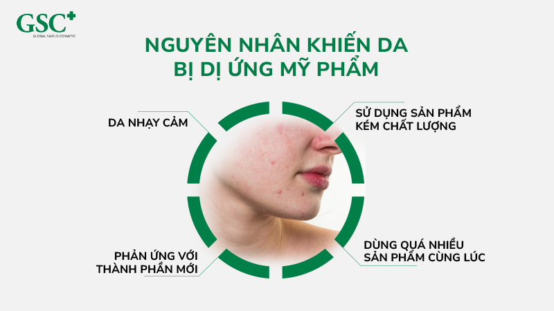 Nguyên Nhân Khiến Da Bị Dị Ứng Mỹ Phẩm