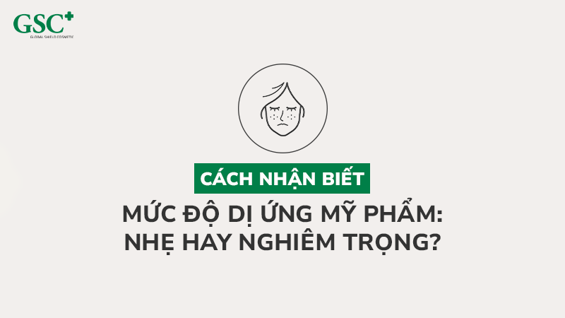 Cách nhận biết mức độ dị ứng mỹ phẩm