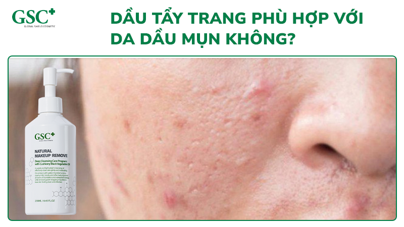 Dầu tẩy trang phù hợp với da dầu mụn không