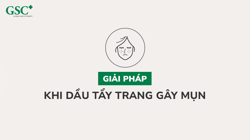 Giải pháp khi dầu tẩy trang gây mụn