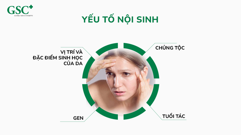 Yếu tố nội sinh