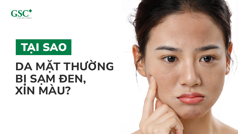 Tại sao da mặt thường bị sạm đen, xỉn màu