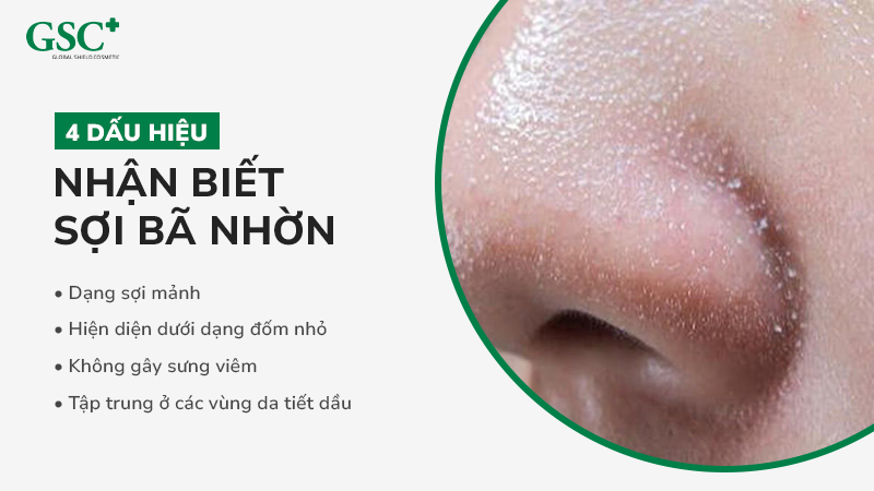 4 dấu hiệu đơn giản nhận biết sợi bã nhờn