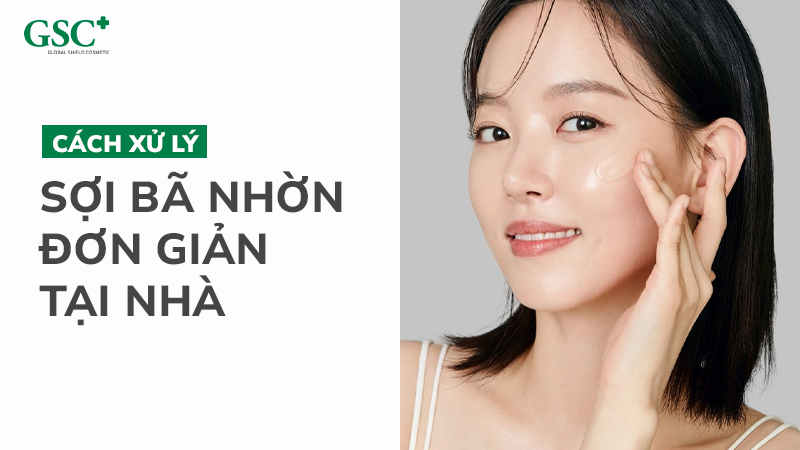 Cách xử lý sợi bã nhờn đơn giản tại nhà