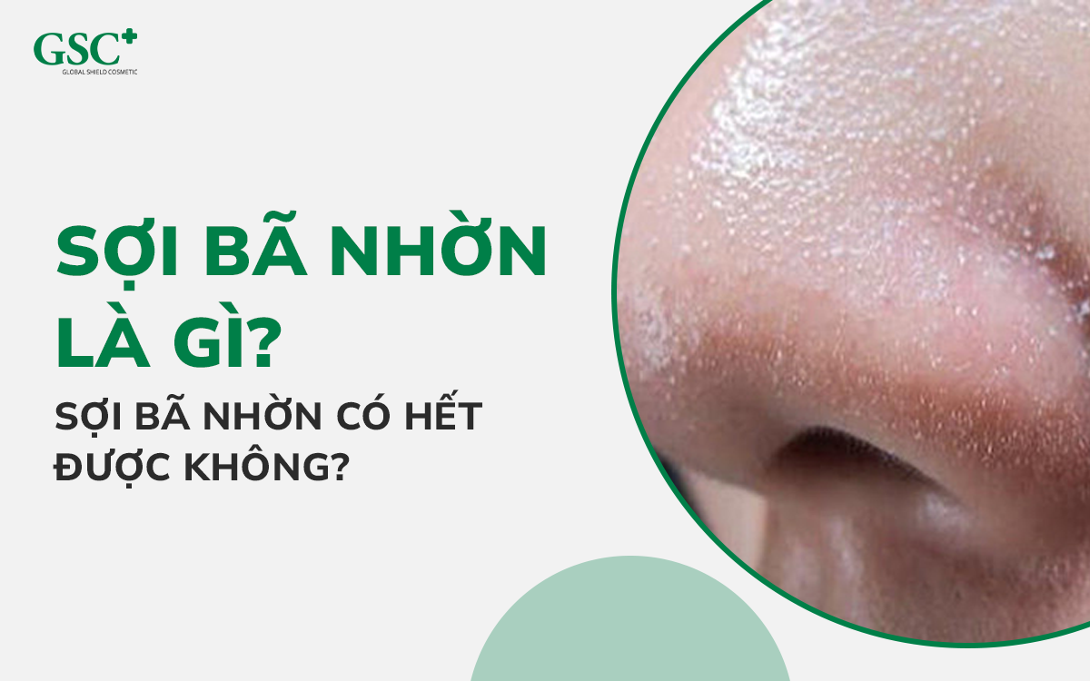 Sợi bã nhờn là gì